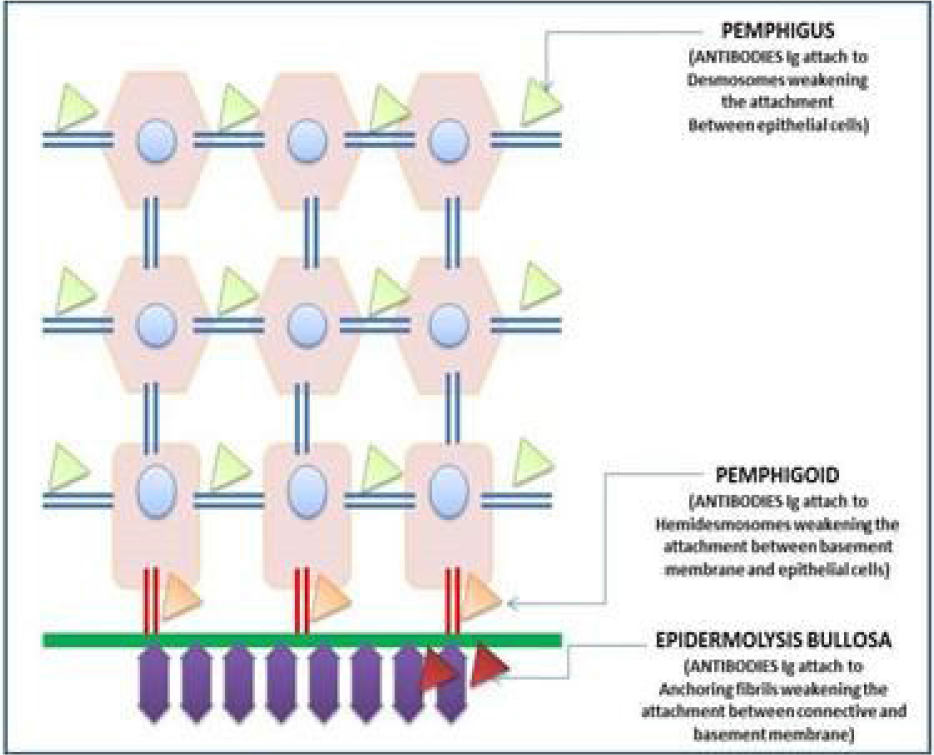 Antibody attachment seen in Pemphigus, Pemphigoid and Epidermolysis Bullosa.