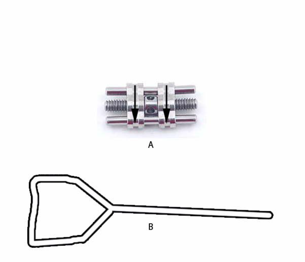 (a) Typical expansion screw. (b) Key used for activation of appliance.