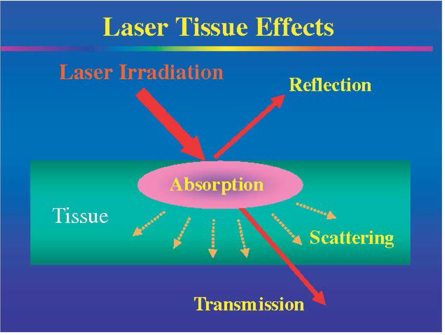 Laser tissue effects.