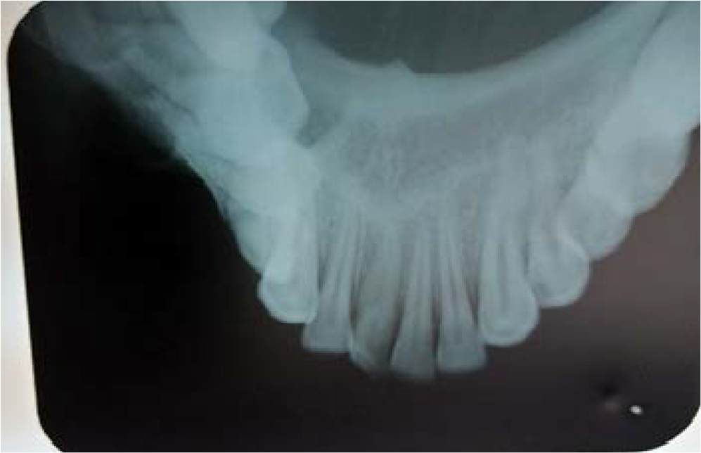 Occlusal radiograph.