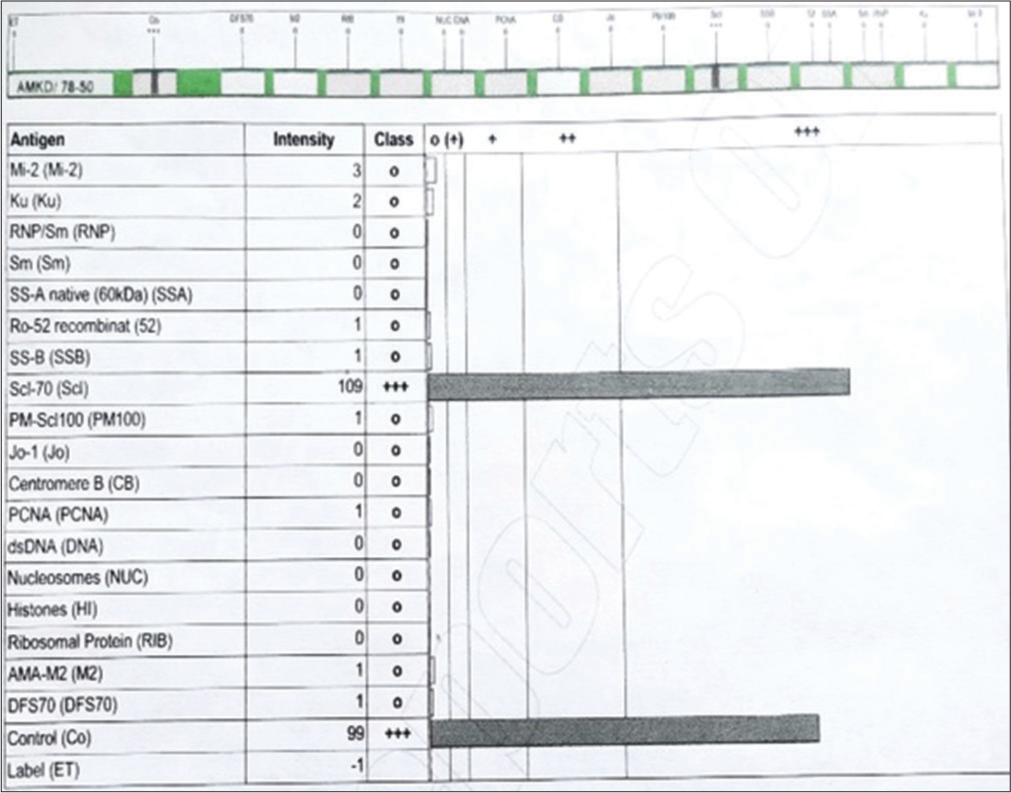 Laboratory report of scl-70 antigen.