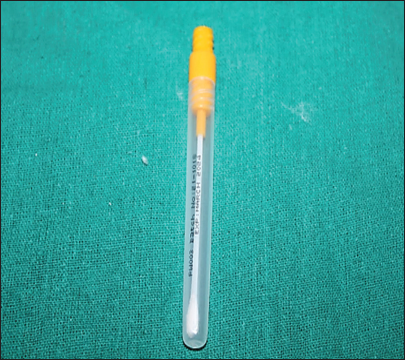 Armamentarium used for collection of swab sample.