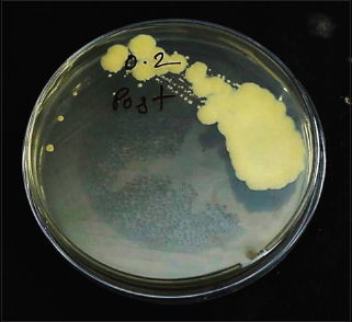 Growth of fungal isolate (other than Mucor) in diabetic denture wearing individual.