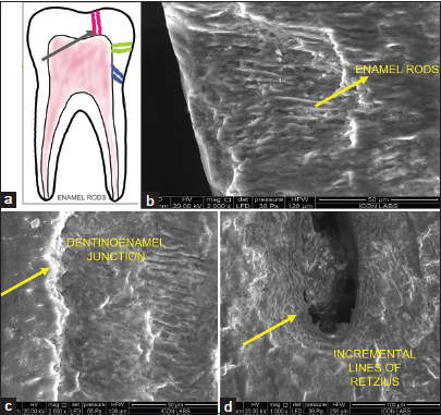 (a) (Digital drawing) different directions of enamel rods (black arrow), (b) enamel rods ESEM, (c) dentinoenamel junction, and (d) incremental lines of enamel (b,c,d- structures are denoted by yellow arrows). ESEM: Environmental scanning electron microscope.