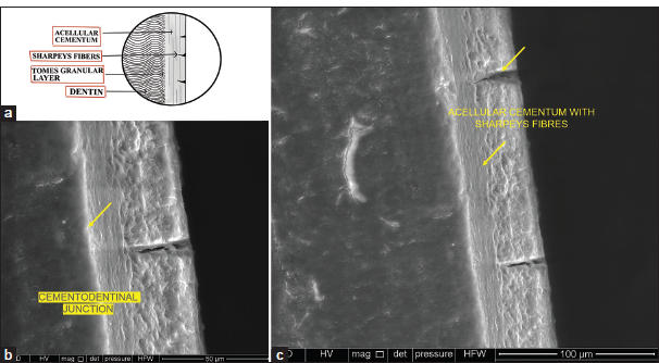(a) (Digital drawing) showing Sharpeys fibers in cementum, (b) Environmental scanning electron microscope (ESEM) Sharpeys fibers in cementum, (yellow arrow) and (c) SEM Sharpeys fibers and acellular cementum (yellow arrow).